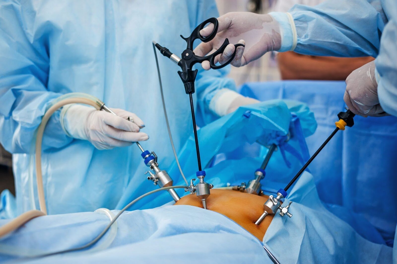 best gynae laparoscopic surgeons in Gurgaon