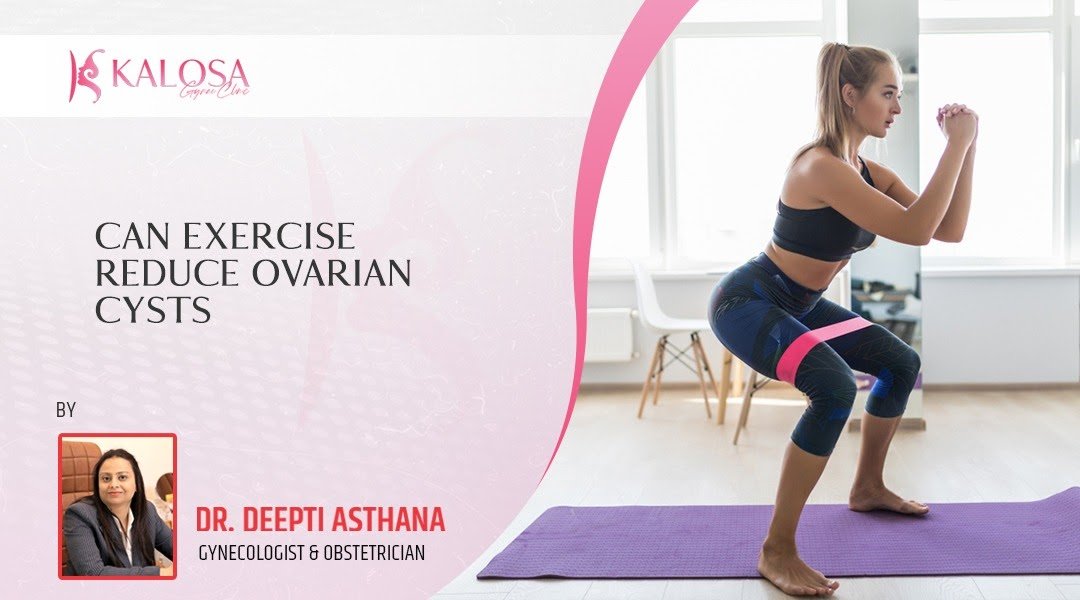 Can I Exercise With Ovarian Cyst