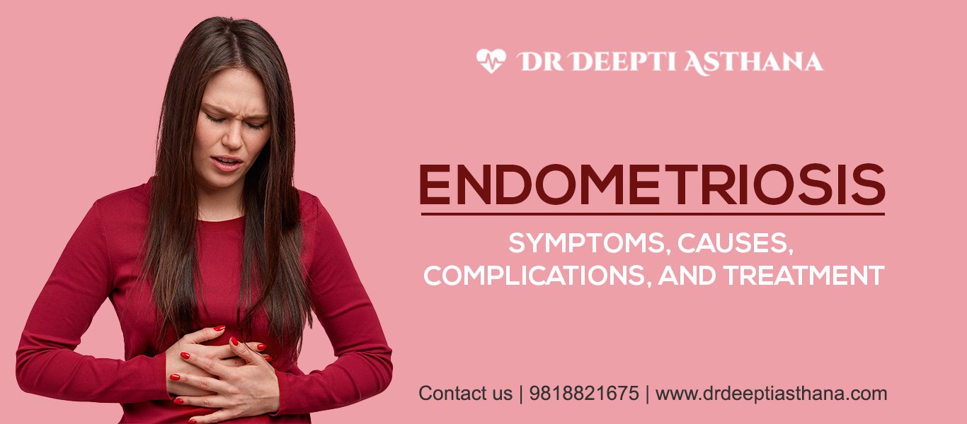 Endometriosis-Symptoms-Causes-Complications-Treatment