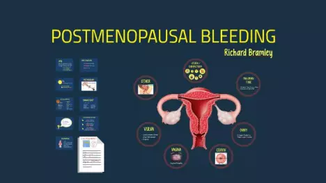 What is Postmenopausal Bleeding - Where does it come from?