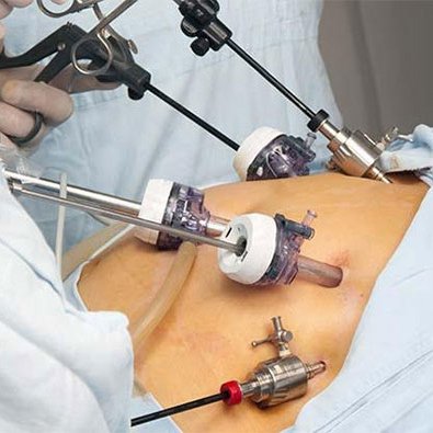 Laparoscopic Surgery in Gurgaon, gynecologist in gurgaon, gynecologist in gurgaon near me, best lady gynecologist in gurgaon, best gynae doctor in gurgaon, Gynaecology hospitals in south city Gurgaon